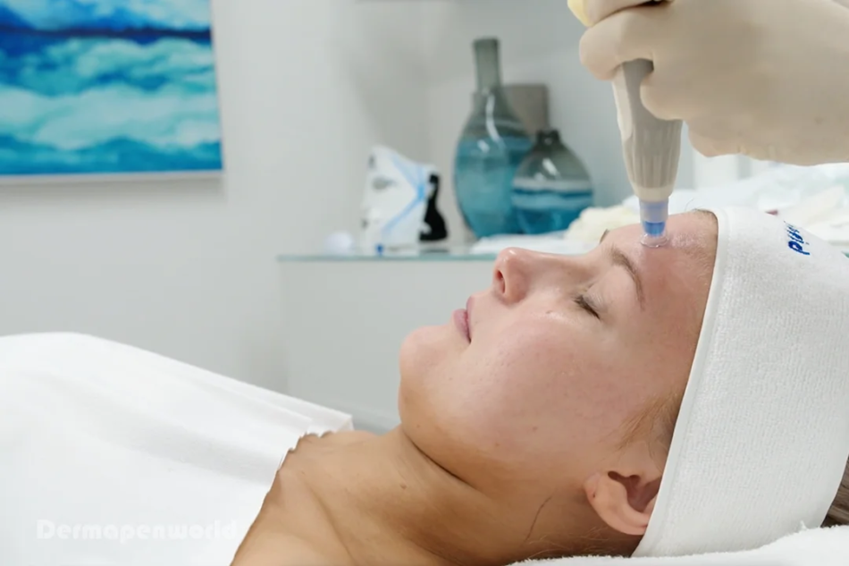 Dermapen Treatment in Dubai