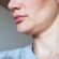 Double Chin Liposuction Dubai