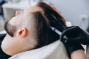 Can PRP Hair Treatment be performed as an outpatient procedure?
