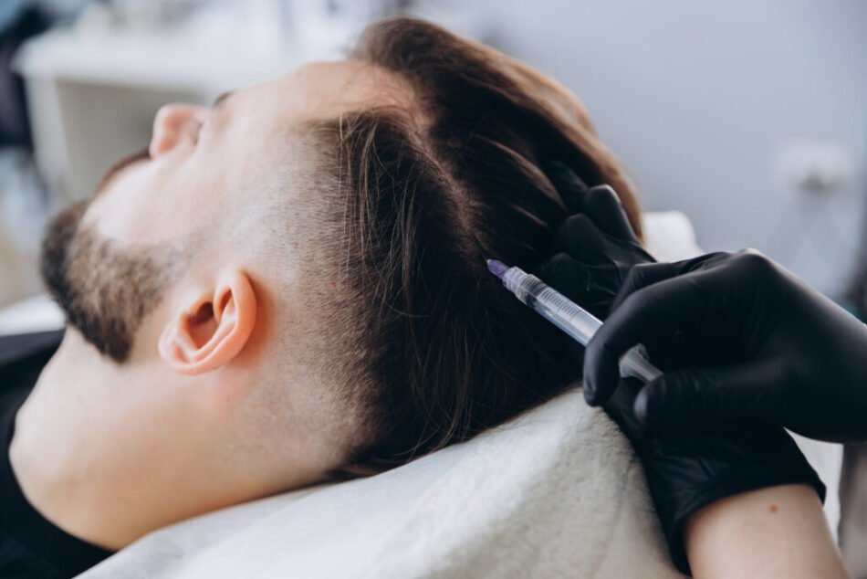 Can PRP Hair Treatment be performed as an outpatient procedure?