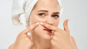 Pimples Treatment in Dubai