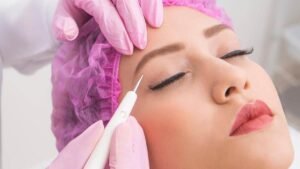 How is Plasma Pen Treatment performed?