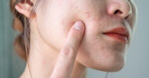How long does a facial capillary treatment session take?