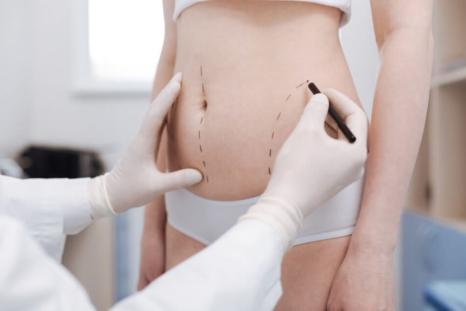 How much does Liposuction cost?