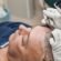 Fue Hair Transplant in Dubai