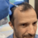 Stem Cell Hair Transplant in Abu Dhabi