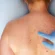 Skin Cancer Screening