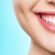 Can teeth whitening improve a smile?