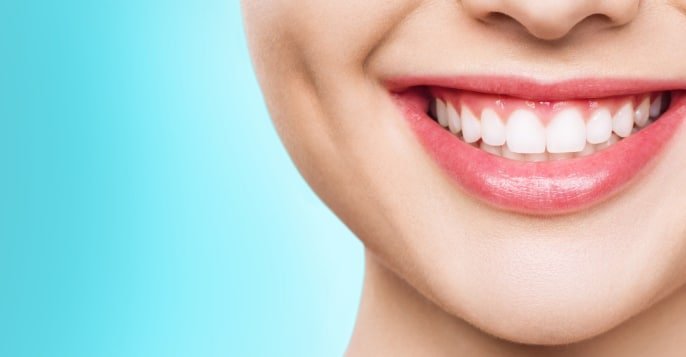 Can teeth whitening improve a smile?