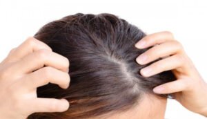 Female Hair Transplants in Dubai