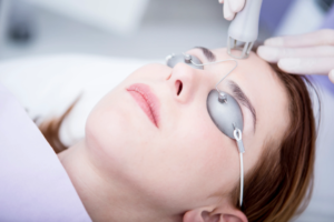 Laser Hair Bleaching in Dubai