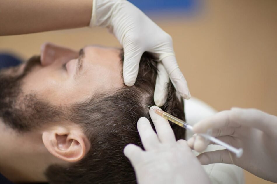 PRP Hair Treatment in Abu Dhabi