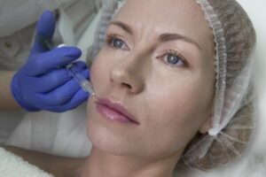 Radiesse Filler Dubai