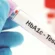 HbA1c-Test-