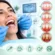 Gum Disease