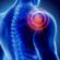 Regenerative Medicine for Rotator Cuff in Bangalore: Exploring Contemporary Shoulder Care